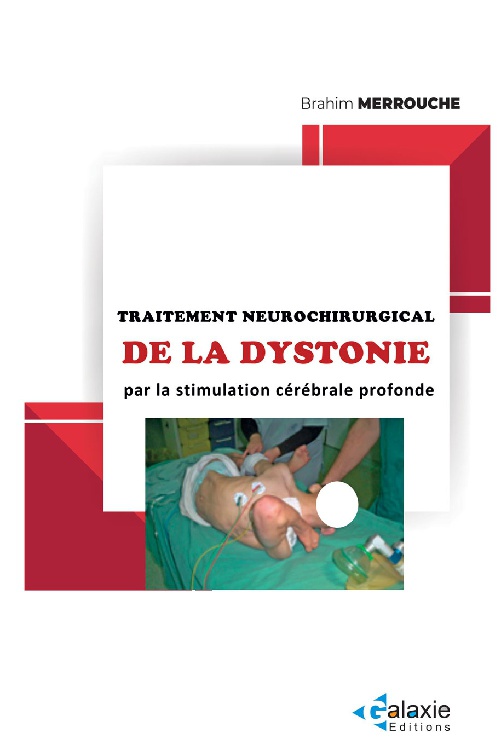 Traitement Neurochirurgical de la DYSTONIE par la Stimulation Cérébrale Profonde