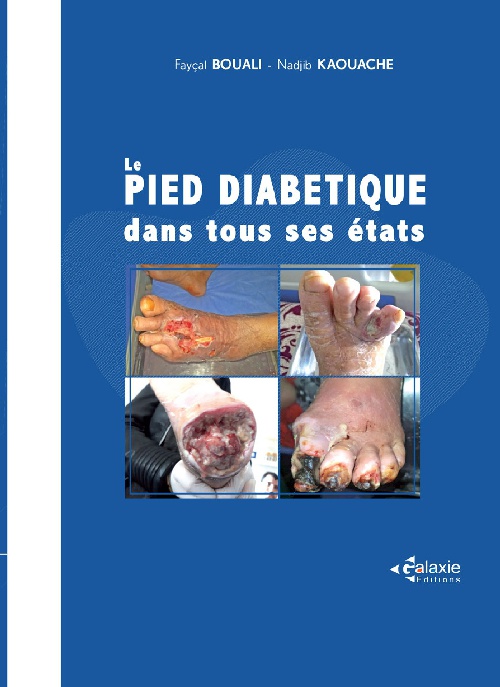 Le PIED DIABÉTIQUE dans tous ses états