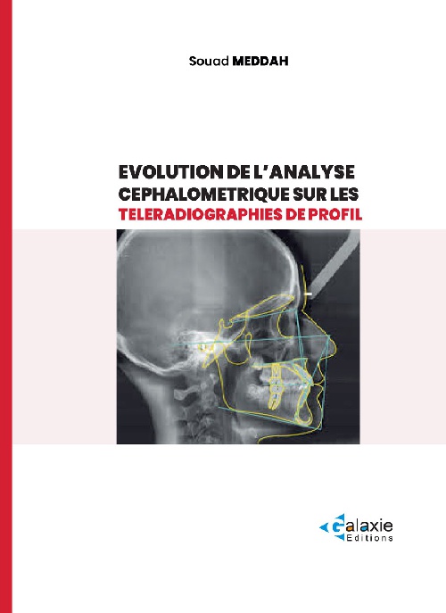 Evolution de l'analyse céphalométrique sur les TÉLÉRADIOGRAPHIES DE PROFIL