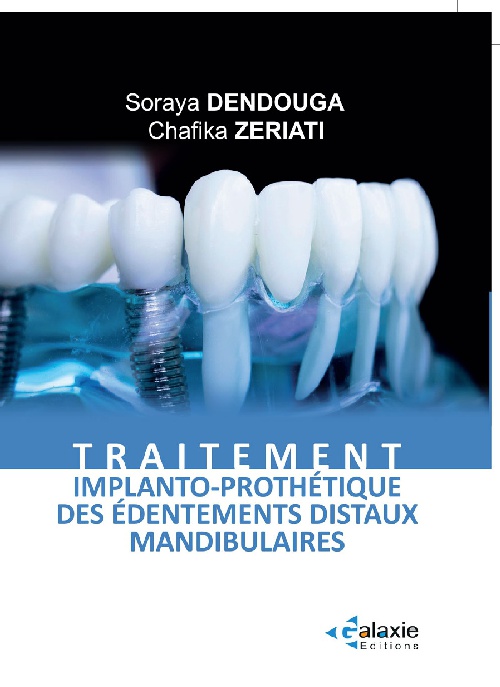 Traitement Implanto-Prothétique des édentements distaux mandibulaires