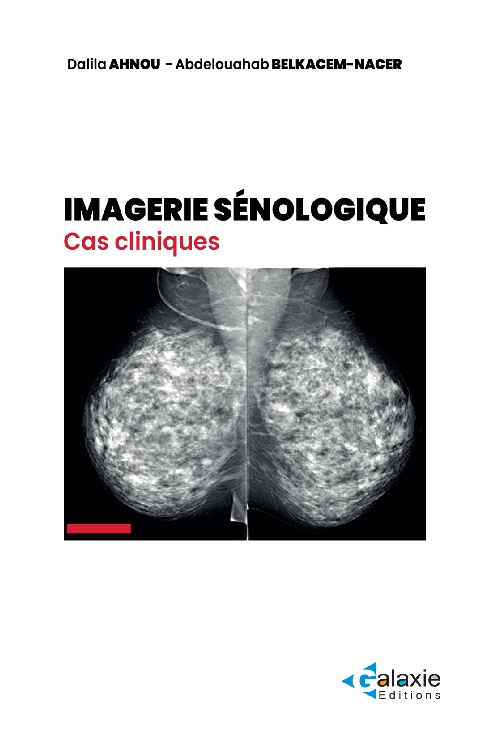IMAGERIE SÉNOLOGIQUE Cas Cliniques