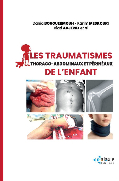 Les Traumatismes thoraco-abdominaux et périnéaux de l'ENFANT